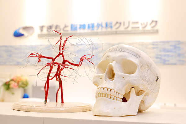すぎもと脳神経外科クリニック 頭痛の原因によっては命の恐れも 軽く考えず脳神経外科の受診を
