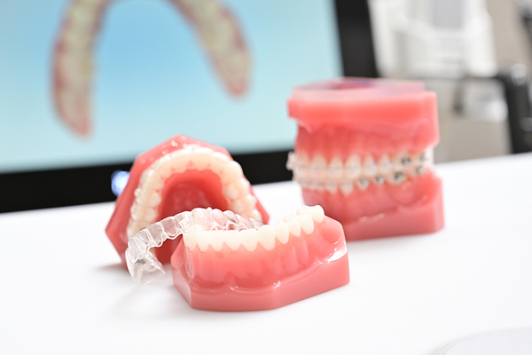 千歳船橋おおむら歯科・矯正歯科 歯列矯正における新しい技術 マウスピース型(アライナー型)装置