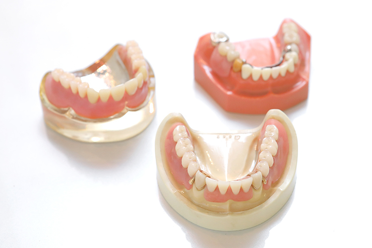 田中歯科 入れ歯が合わず、作り直したい時は 信頼できる歯科医院選びが大切