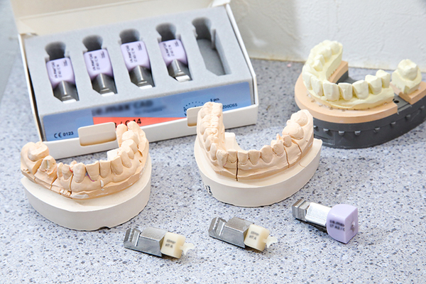 マリコ歯科クリニック 歯科材料と治療法の適切な選択で 再治療のない虫歯治療をめざす