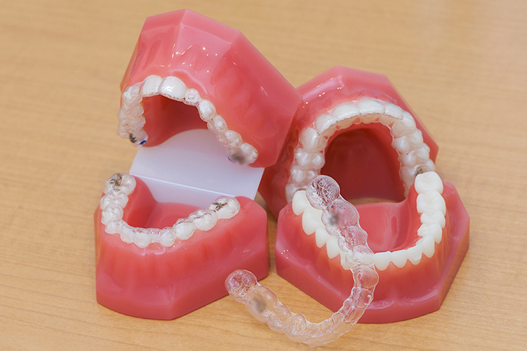 Ohana Dental Clinic マウスピース型装置で 自身のライフスタイルに合わせた矯正を