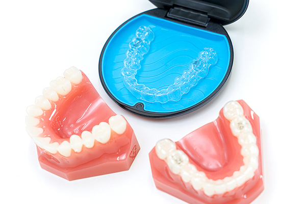 エムズデンタルクリニック 目立ちにくく痛みも少ない マウスピース型装置を用いた矯正