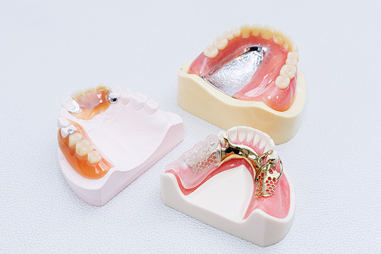 ナルトミ歯科医院 「補綴治療」を長持ちさせるため 精密な基本治療と適切な材料選択