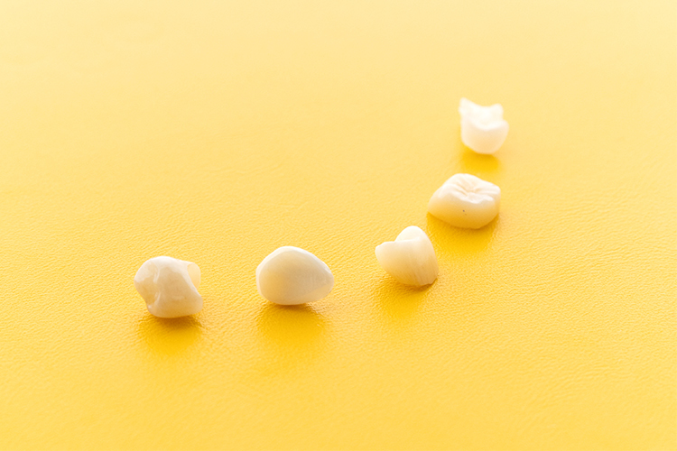 東京神楽坂歯科 虫歯治療を受ける際に知っておきたい 保険診療と自由診療の違い