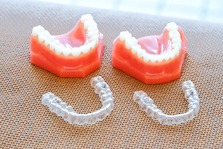 おおの歯科・矯正歯科 矯正中の虫歯・歯周病リスクに配慮 マウスピース型装置による矯正