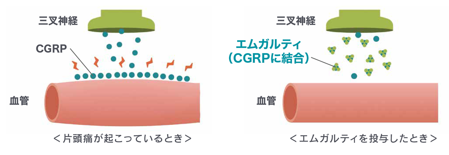 ながつた脳神経外科 お知らせ1